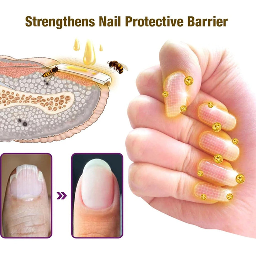 Fungi Free Bee Venom Nail Treatment Solution Serum (15ml) Buy 1 Get 1 Free