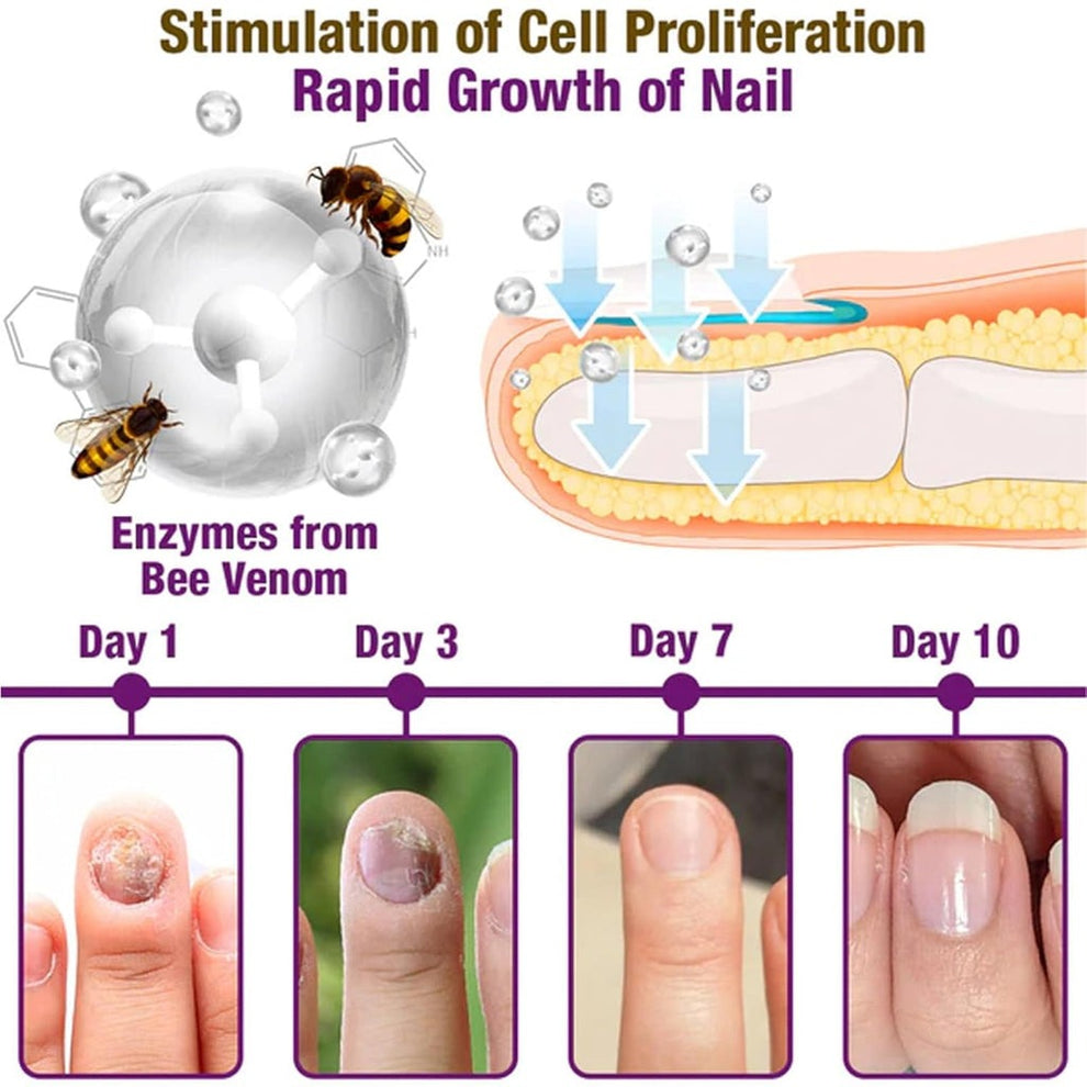 Fungi Free Bee Venom Nail Treatment Solution Serum (15ml) Buy 1 Get 1 Free